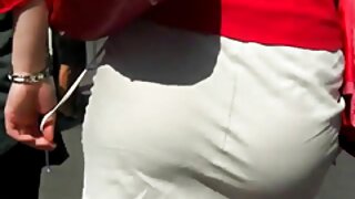 گنجے سر والا سیاہ پڑ ...